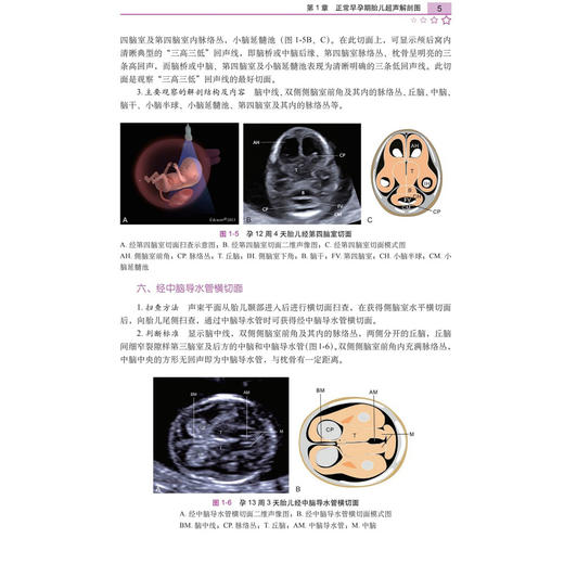 正常胎儿生长发育超声标准参考图谱 李胜利 袁鹰 文华轩 适用于各级医院超声科医师产科医师助产士产科护士等阅读参考 科学出版社 商品图4