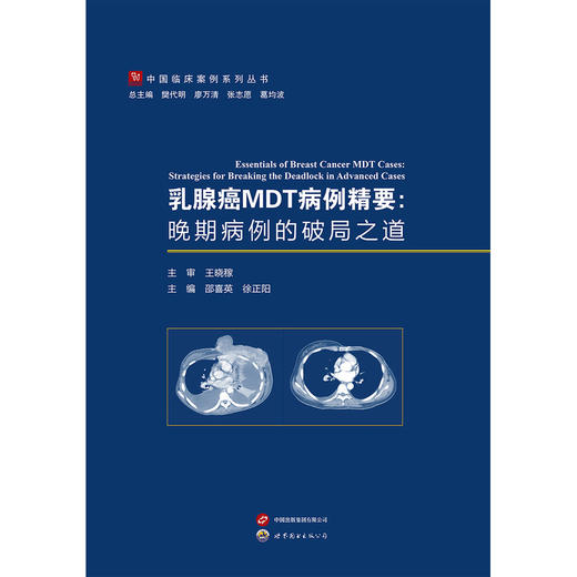 乳腺癌MDT病例精要:晚期病例的破局之道 商品图0