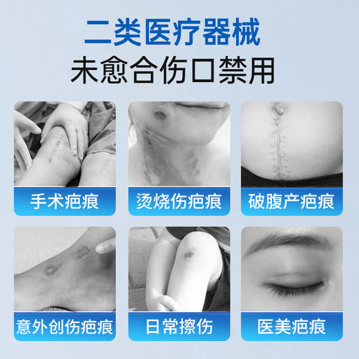 【官方正品】云南白药泰邦祛疤硅凝胶疤痕贴去疤烫伤手术剖腹产增生修复疤痕片 商品图2