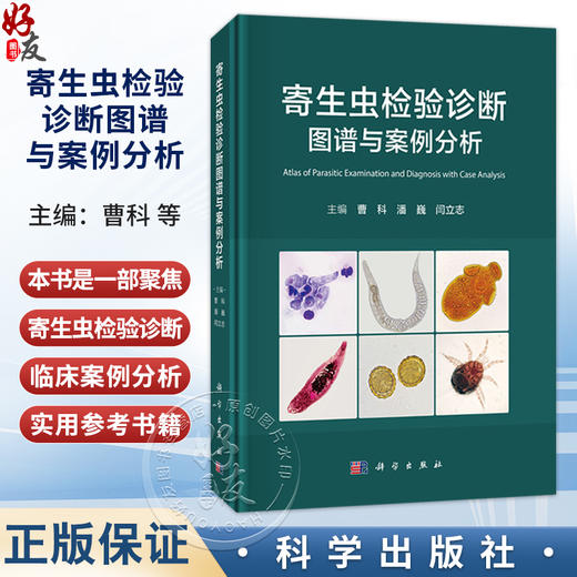 寄生虫检验诊断图谱与案例分析 曹科 潘巍 闫立志 一部聚焦寄生虫检验诊断和临床案例分析的专业书籍 9787030845962科学出版社 商品图0