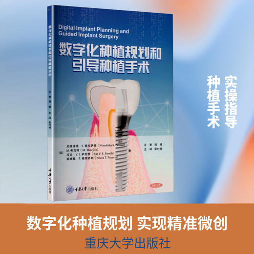 数字化种植规划和引导种植手术 商品图0