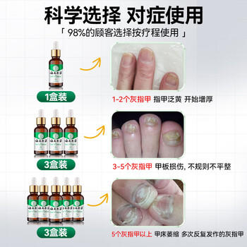 纯春堂云南本草灰指甲专用特殊效中草药抑菌液增厚发黄中空灰甲净护理盒 商品图3
