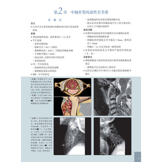 骨肌影像诊断学：非创伤性疾病（中文翻译版 原书第3版）李天然 尚柳彤 适合影像科医生骨科医生等相关专业人员阅读参考科学出版社 商品图4