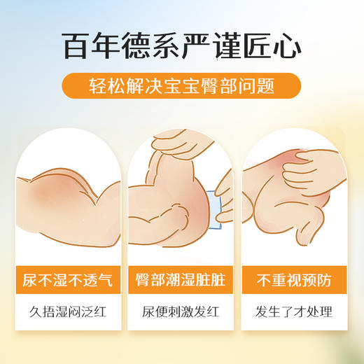 【品牌直营】Weleda维蕾德 金盏花婴儿护臀膏 保护臀部 pp霜 75ml/盒 商品图5