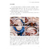 脑皮质下神经外科学 王冀伟 王明栋 主译 全书涵盖脑出血、皮质下肿瘤、脑室内胶样囊肿等多种病变 神经外科 辽宁科学技术出版社 商品缩略图4