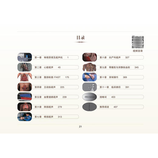 重症超声手册第5五版 徐鹏 吴刚 蒋京京 译 配有200个左右视频动画 为护理等各类临床医护人员提供了简便易学的教程人民卫生出版社 商品图3