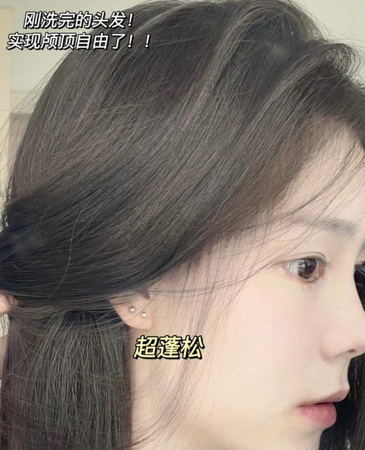 胖东来爆款【伯纳乌1%二硫化硒去屑洗发水】头屑不反复，控油蓬松超清爽！洗一次爽三天!1%二硫化硒源头抑制马拉色菌过度繁殖! 商品图4