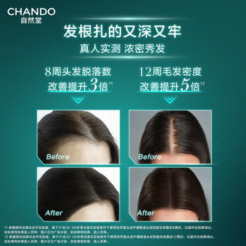 自然堂头皮护理控油防脱洗发水550ml止痒去油舒缓洗头膏男女赵露思推荐 /个人护理 /洗发护发 /洗发水 商品图3