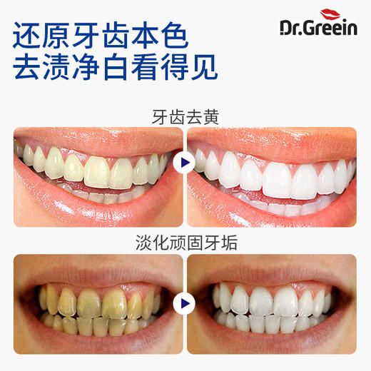 三色分区 搞定全家口腔需求 | 韩国原装进口Dr. Greein格芮茵牙膏系列 日常口腔清洁护理 120g*3支家庭装 商品图11