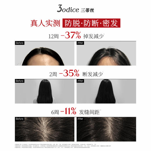 【新品上市】3odice三蒂丝红盾防脱洗发水防断固发蓬松控油洗发露 商品图1