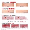 喜辽妥壬二酸祛痘精华霜15g/支 商品缩略图2