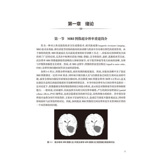 MRI图像超分辨率重建 贾媛媛 杜井龙 吕发金 主编 医工融合 前沿理论 呈现了MRI图像超分辨率重建领域的全貌 人民卫生出版社 商品图4