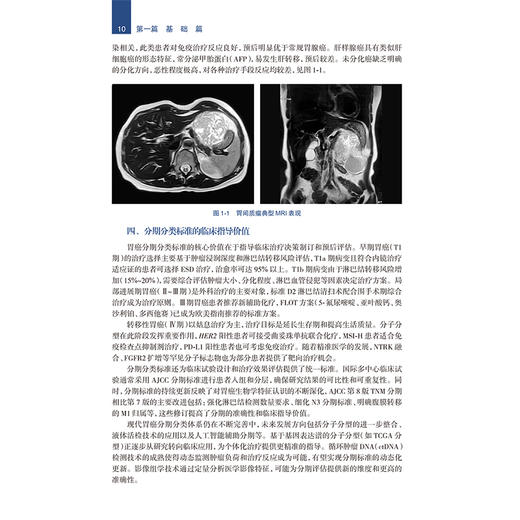 机器人胃癌手术与循证实践 蔡辉 主编 本书适用于所有胃癌外科与机器人外科领域的工作者 医药 卫生 9787117395274 人民卫生出版社 商品图4