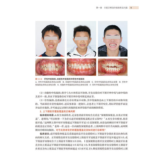 口腔正畸临床常见问题解析 李煌 主编 读者对象主要为中年资口腔正畸医生 即口腔正畸规范化培养培阶段的医生 人民卫生出版社 商品图4