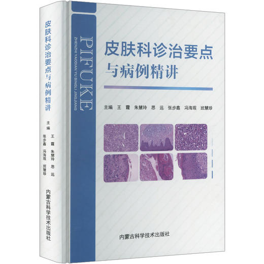 皮肤科诊治要点与病例精讲 商品图0
