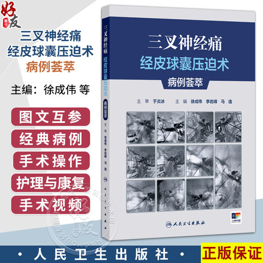 三叉神经痛经皮球囊压迫术病例荟萃 徐成伟 李岩峰 马逸 主编 附带约10个经典病例手术视频 9787117392068 人民卫生出版社 商品图0