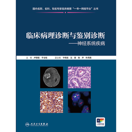 临床病理诊断与鉴别诊断--神经系统疾病 商品图1