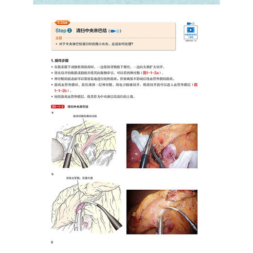 思辨与共识：下消化道术式的优劣与奥义【日】山口 茂树 王利明 李杰 涵盖适应证 禁忌证 操作步骤与技巧等 辽宁科学技术出版社 商品图4