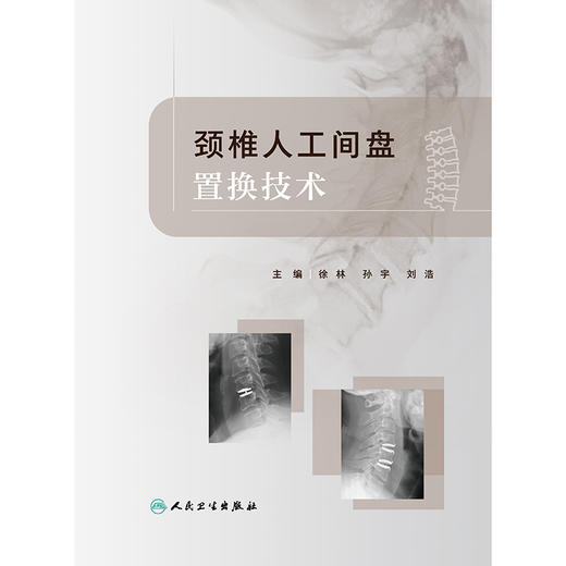 颈椎人工间盘置换技术 商品图1