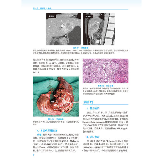 肝胆胰疑难疾病多学科诊治集萃 陆才德 主编 病例涵盖肝胆胰腺各领域，60余例病例中包含多个肝胆胰腺疾病种类 人民卫生出版社 商品图4