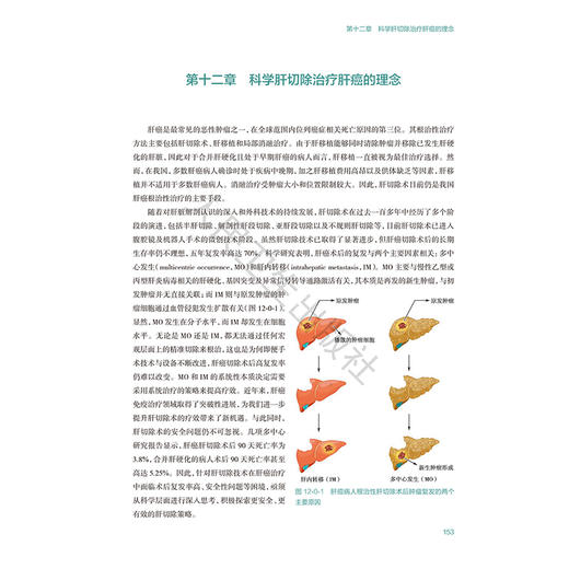 科学肝切除：肝癌外科治疗新理念 黄志勇 系统阐释肝癌外科治疗新理念、关键技术与操作要点 高清图解和影像图片等 人民卫生出版社 商品图4