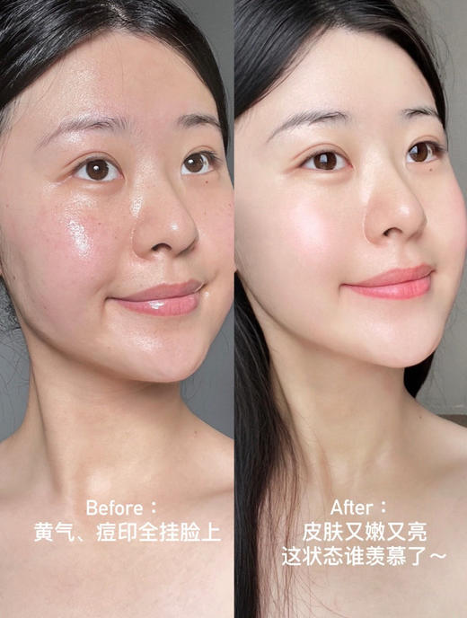 【两盒】润百颜水光玻尿酸补水舒缓提亮肉肉面膜2.0 商品图6