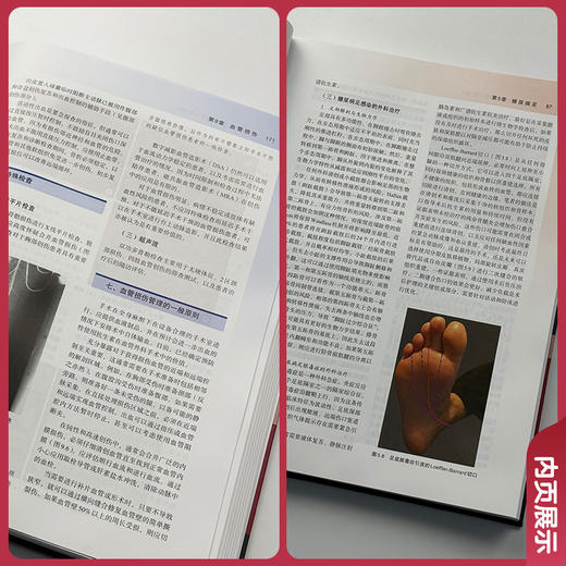 血管与腔内血管外科学 第7七版 郑月宏 张磊 郭明金 贺新奇 主译 慢性下肢缺血的评估等 9787567925564 中国协和医科大学出版社 商品图4
