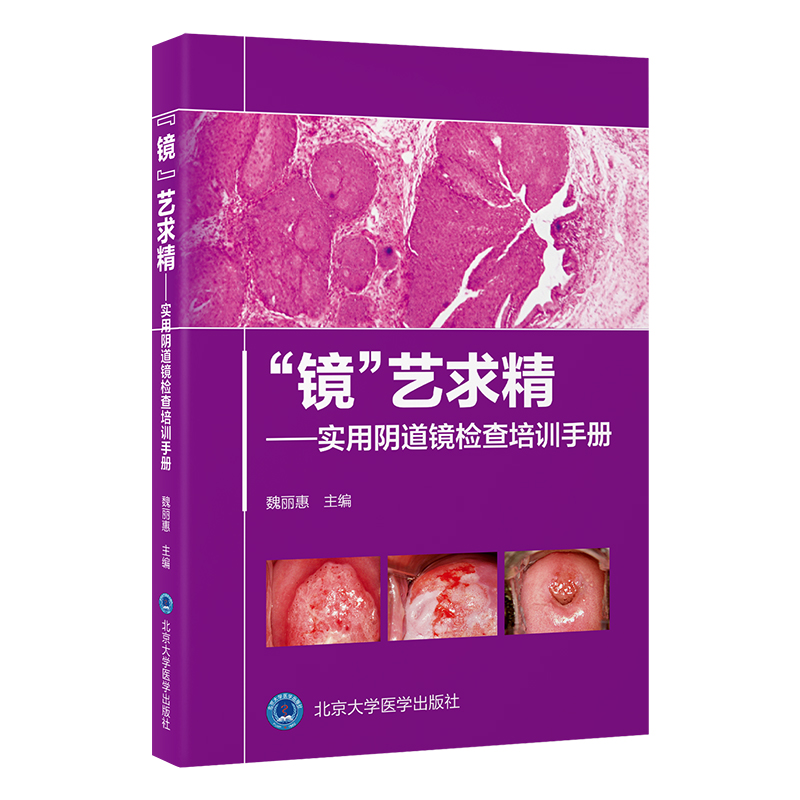 “镜”艺求精——实用阴道镜检查培训手册  主编 ： 魏丽惠  北医社