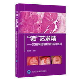 “镜”艺求精——实用阴道镜检查培训手册  主编 ： 魏丽惠  北医社