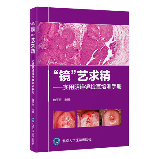“镜”艺求精——实用阴道镜检查培训手册  主编 ： 魏丽惠  北医社 商品图0