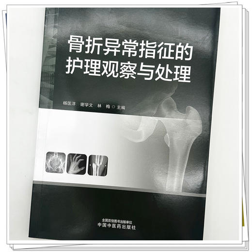 骨折异常指征的护理观察与处理 杨匡洋 谢学文 林梅 主编 中国中医药出版社 商品图3