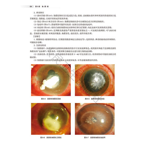 临床眼科学 俞阿勇 主编 浙江省普通本科高校 十四五 新工科 新医科 新农科 新文科重点教材 9787117394482 人民卫生出版社 商品图4