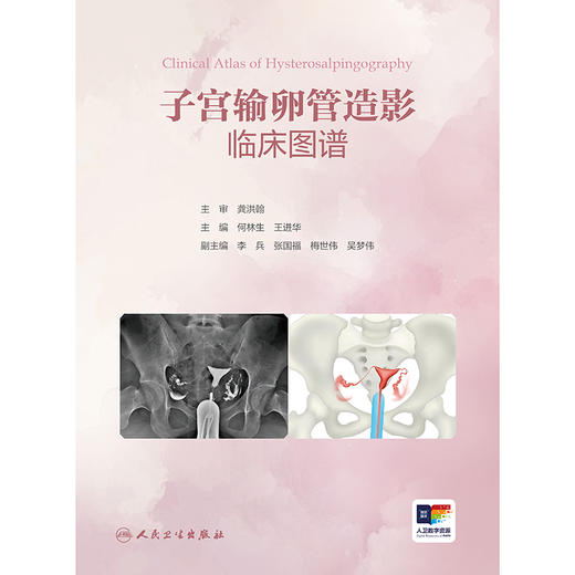 子宫输卵管造影临床图谱 商品图1