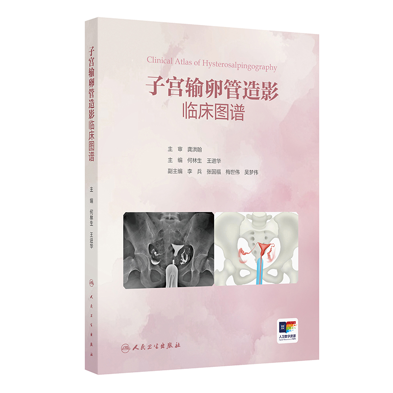 子宫输卵管造影临床图谱