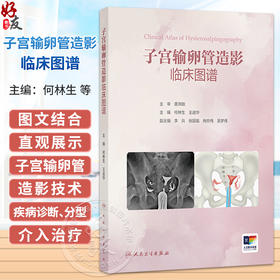 子宫输卵管造影临床图谱 何林生 王进华 本书是妇科 生殖 影像和输卵管介入医生及教学工作者的实用案头参考书 人民卫生出版社