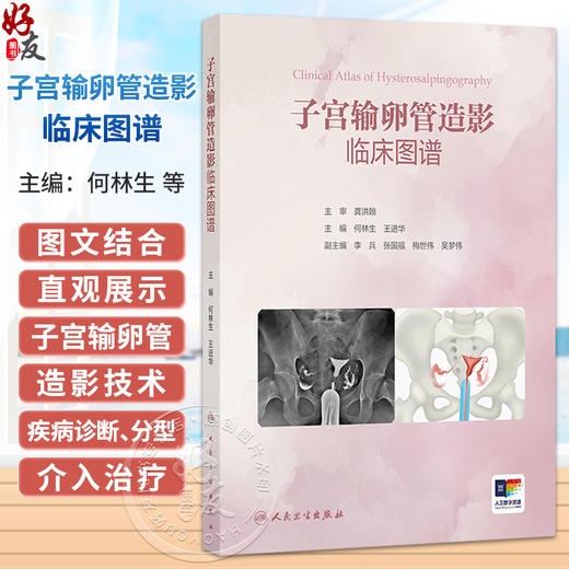 子宫输卵管造影临床图谱 何林生 王进华 本书是妇科 生殖 影像和输卵管介入医生及教学工作者的实用案头参考书 人民卫生出版社 商品图0