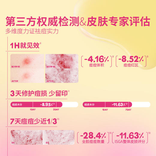 【祛痘精华】MUSE&FRIENDS  无酸祛痘棒 12Y+儿童可用 商品图2