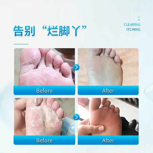 CUREPAIR 清足膏 清除脚气 精致细嫩 50g/罐 商品图5