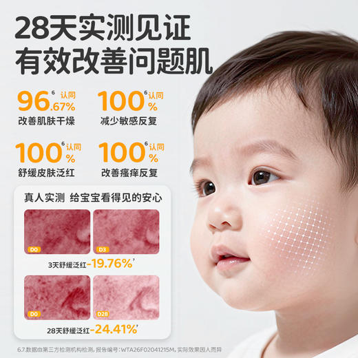 【特护精华霜100g】蓓雀儿婴童倍润特护精华霜 2026升级版 0岁+ 商品图1