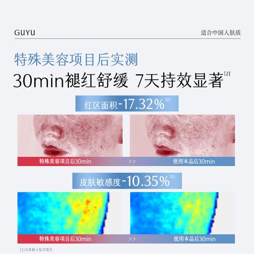 【双11囤货金喜】谷雨重组胶原蛋白修护贴（5片/盒）精准修御干·敏·红 买越多送越多 商品图7