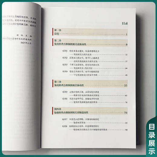 肿瘤免疫治疗不良反应的诊治与临床病例精粹 赵林 王湘 主编 全流程实战指导 经典与疑难并重9787567928497中国协和医科大学出版社 商品图3