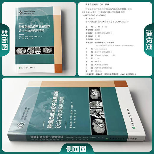 肿瘤免疫治疗不良反应的诊治与临床病例精粹 赵林 王湘 主编 全流程实战指导 经典与疑难并重9787567928497中国协和医科大学出版社 商品图1