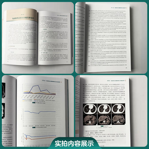 肿瘤免疫治疗不良反应的诊治与临床病例精粹 赵林 王湘 主编 全流程实战指导 经典与疑难并重9787567928497中国协和医科大学出版社 商品图2