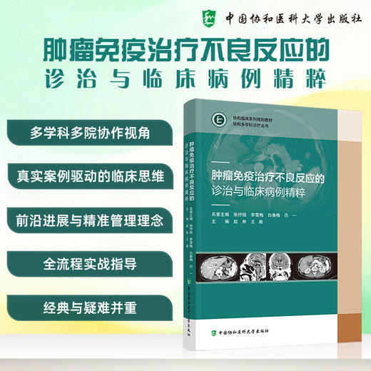 肿瘤免疫治疗不良反应的诊治与临床病例精粹 赵林 王湘 主编 全流程实战指导 经典与疑难并重9787567928497中国协和医科大学出版社 商品图0