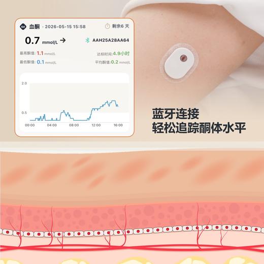 【优选上新】野兽优选｜中文版Meta Twin x 硅基SiBio联名 KS3动态血酮仪持续酮体监测系统（跨境海淘商品不支持7天无理由退换） 商品图2