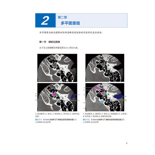 0.1mm分辨率CT耳部解剖及常见病变图谱 赵鹏飞 尹红霞 主编 为耳科及影像科医师提供全方位、高价值的专业支持 人民卫生出版社 商品图4