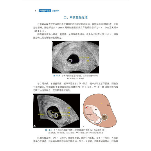 产科超声检查切面解析 冉素真 张晓航 主编 可供超声诊断医生 产科医生及研究生阅读 临床医学 9787030855107 科学出版社 商品图4