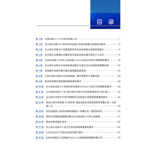 天坛神经介入手术荟萃 马宁 杨新健 精选北京天坛医院19例复杂脑血管疾病介入病例 呈现多项关键前沿介入技术 北京大学医学出版社 商品图3