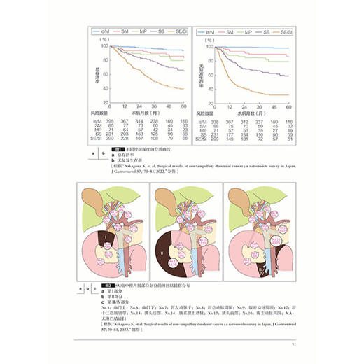 胃与肠 2026年第四期 非壶腹部十二指肠浸润癌的临床病理特征 日本 胃与肠 编委会 编著 9787559146434 辽宁科学技术出版社 商品图3