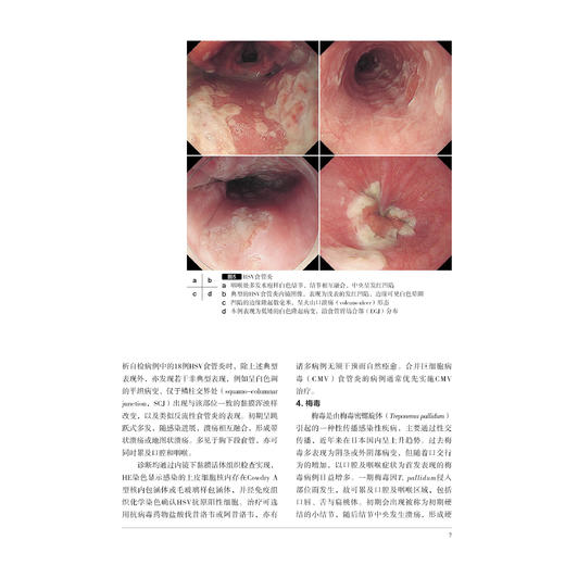 胃与肠 消化道感染性疾病的病理与影像诊断更新 通过病例提升应用能力 胃与肠翻译委员会 9787559146250 辽宁科学技术出版社 商品图4